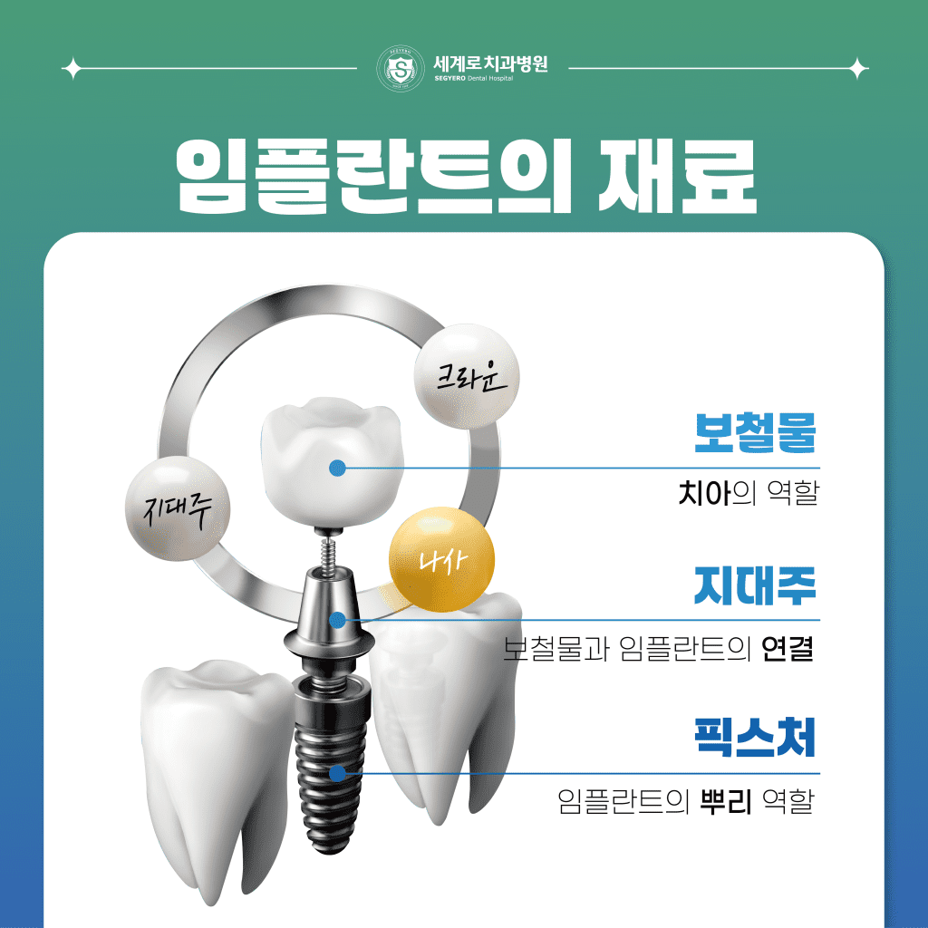 임플란트의 재료와 구성