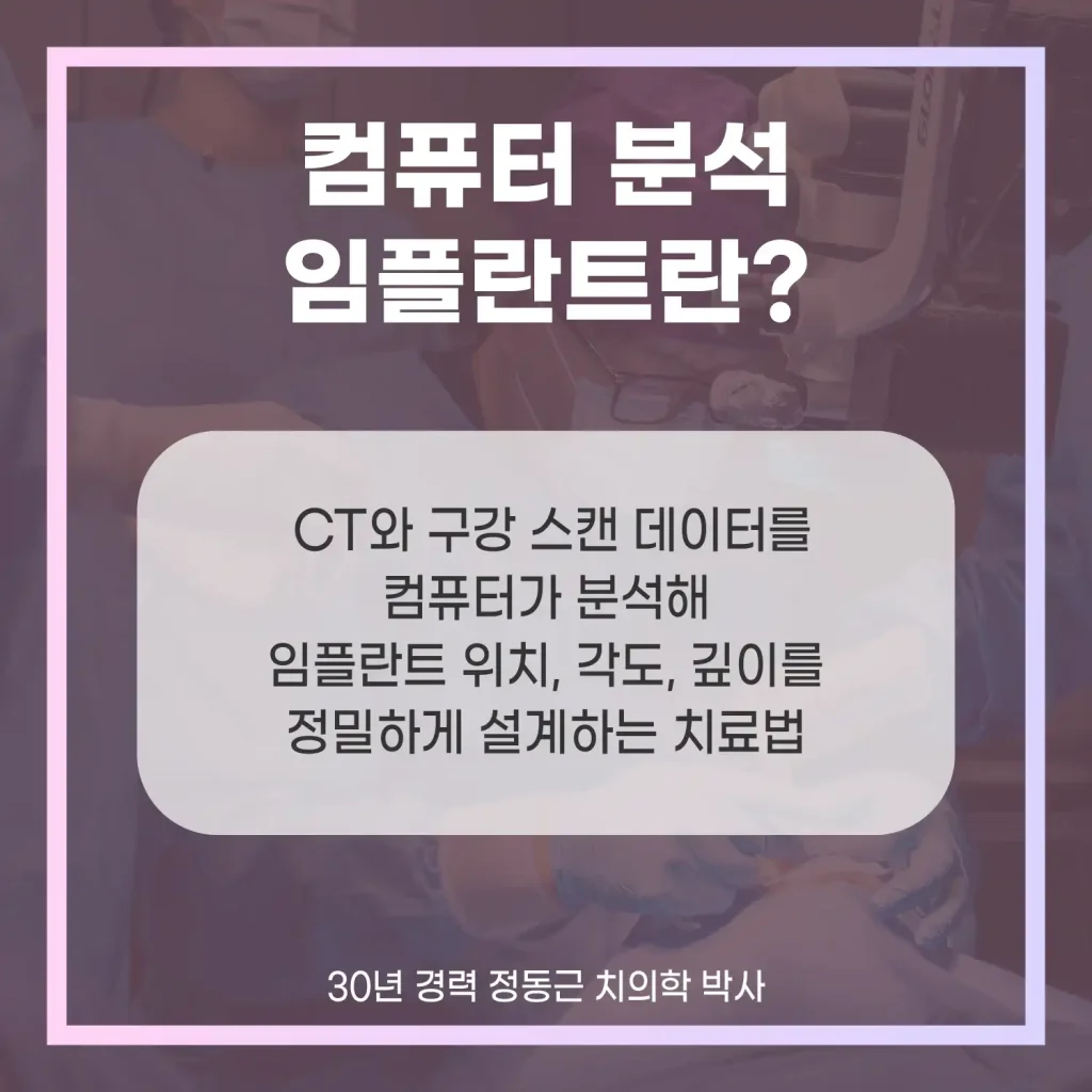부산 컴퓨터 분석 임플란트란?