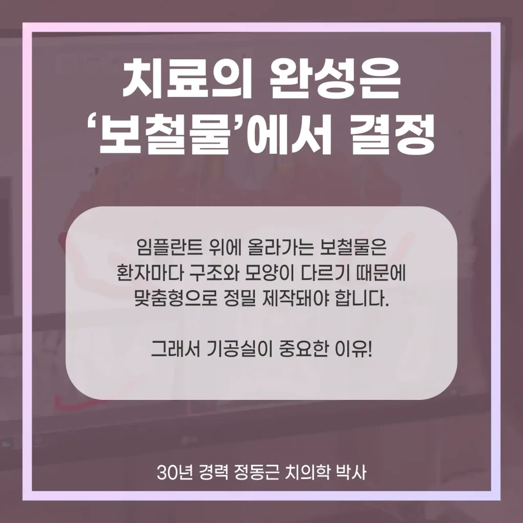 치료의 완성은 보철물에서 결정