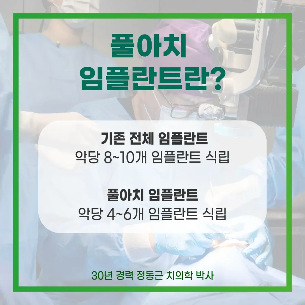 풀아치 임플란트란