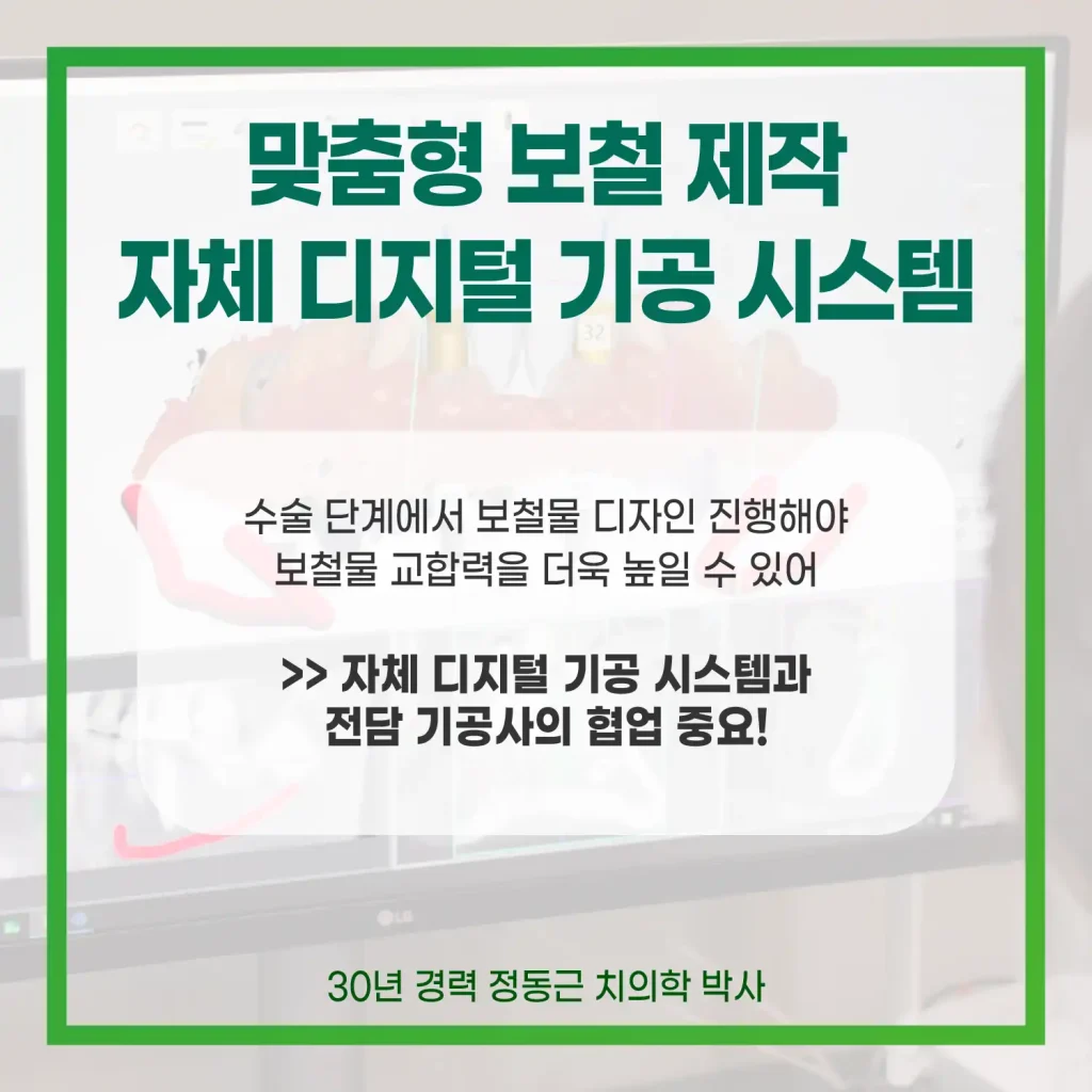 맞춤형 보철 제작 자체 디지털 기공 시스템