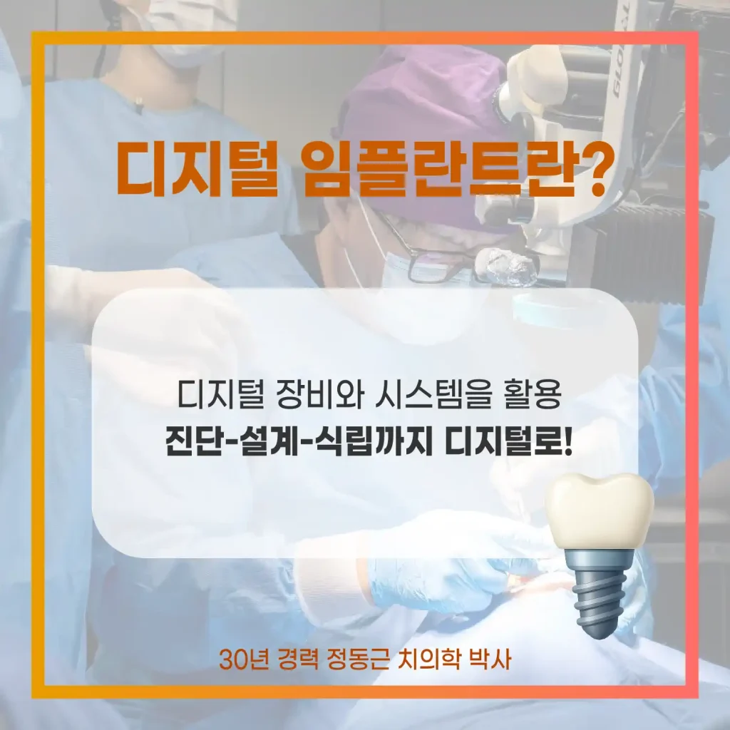 디지털 임플란트란?