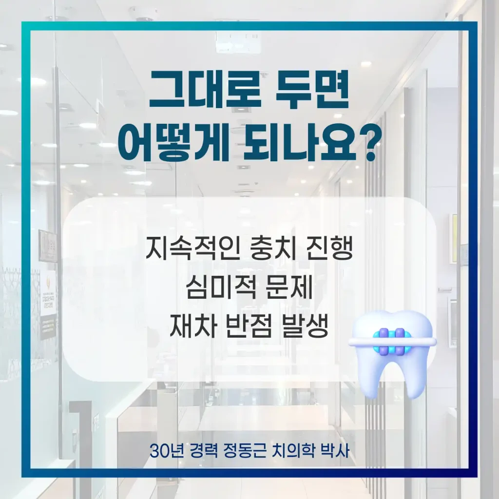 치아흰색반점 그대로 두면