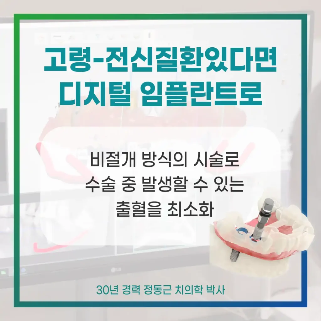 고령 전신질환은 디지털 임플란트로