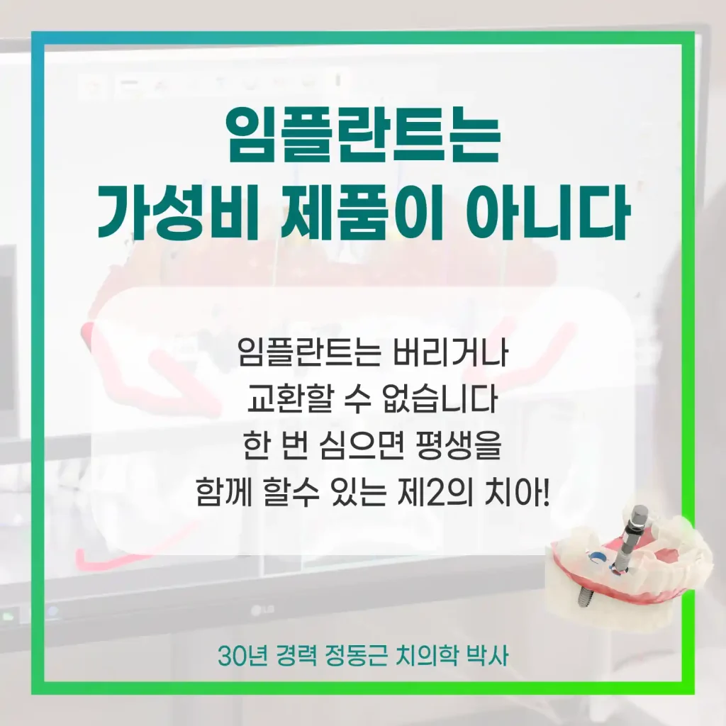 임플란트는 가성비 제품이 아니다