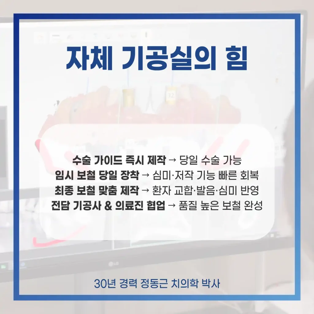 해운대전체임플란트 자체 기공실