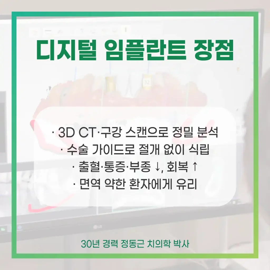 디지털 임플란트 장점