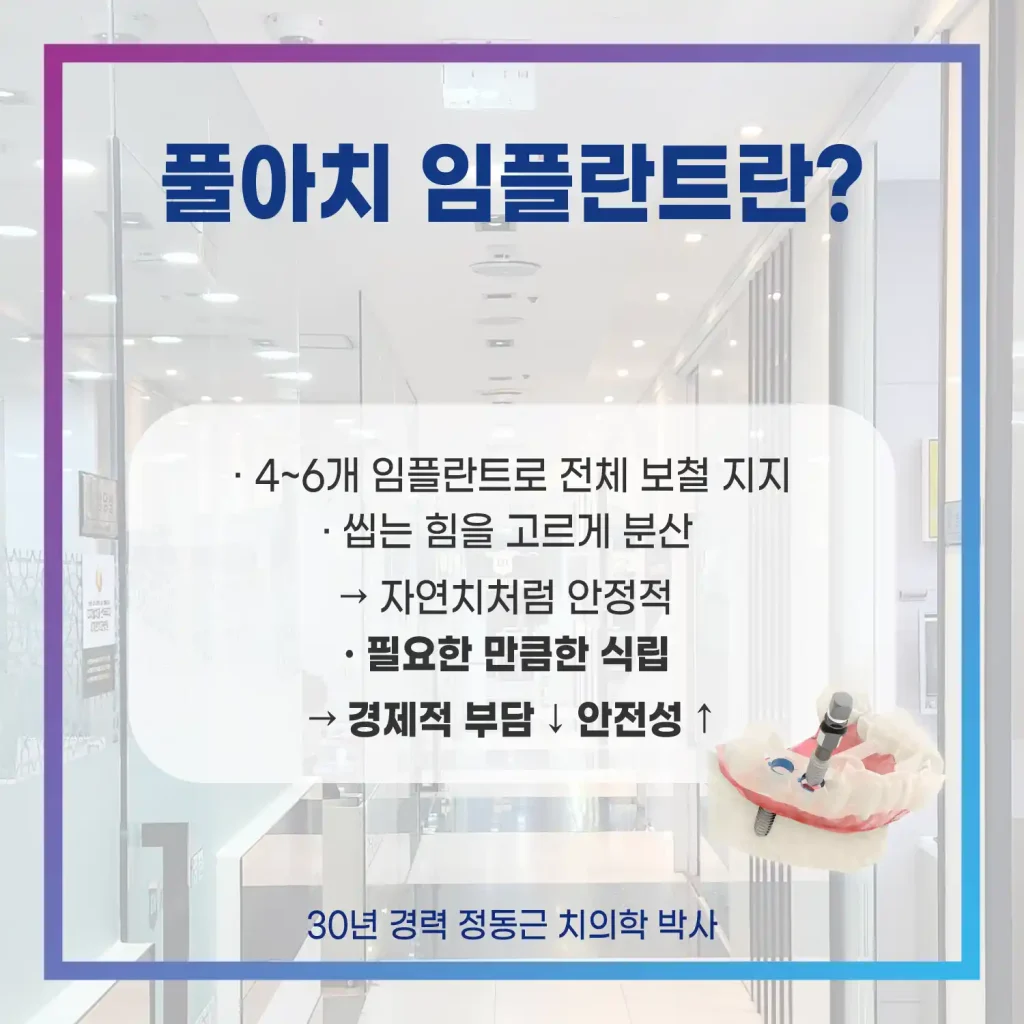 풀아치임플란트란