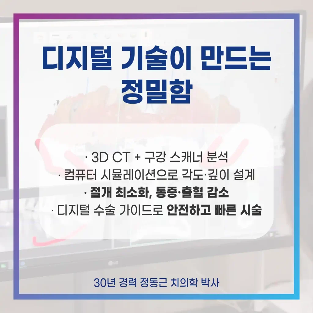 부산전체임플란트 디지털 기술