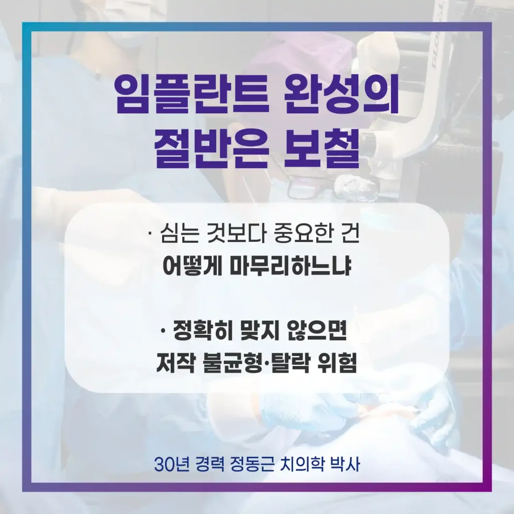 부산 컴퓨터분석임플란트 완성의 절반은 보철