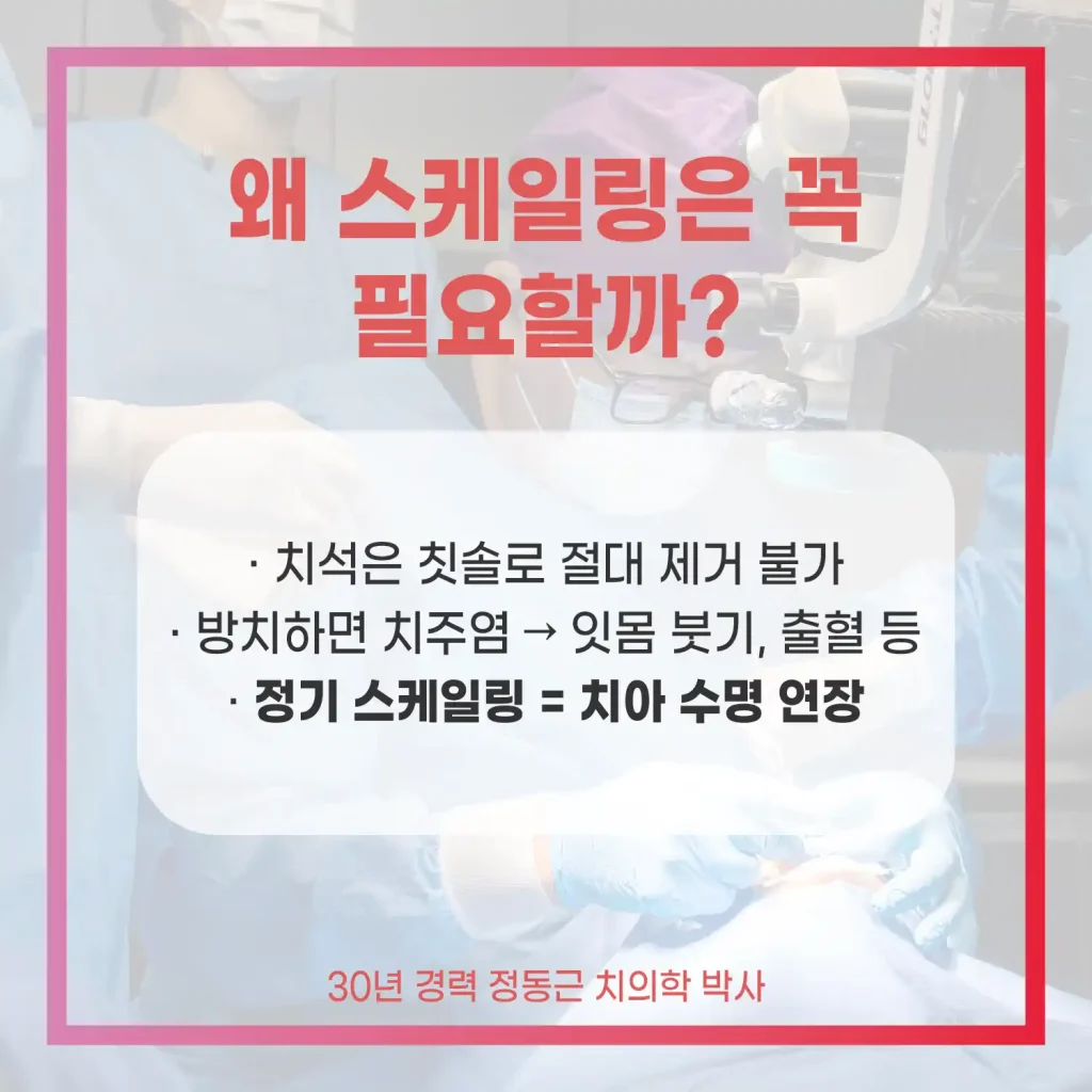부산 안아픈 스케일링 필요한 이유