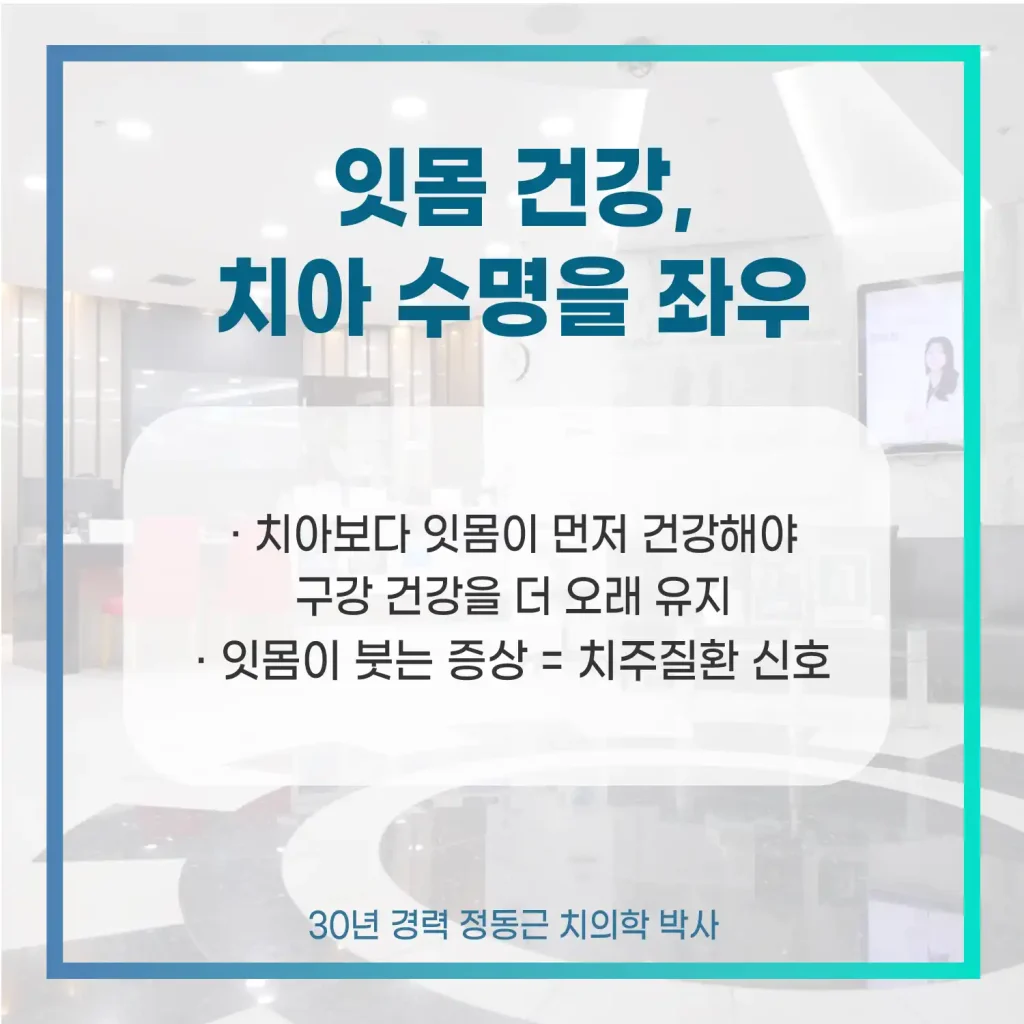 잇몸이붓는이유 알아야 치아수명 좌우합니다