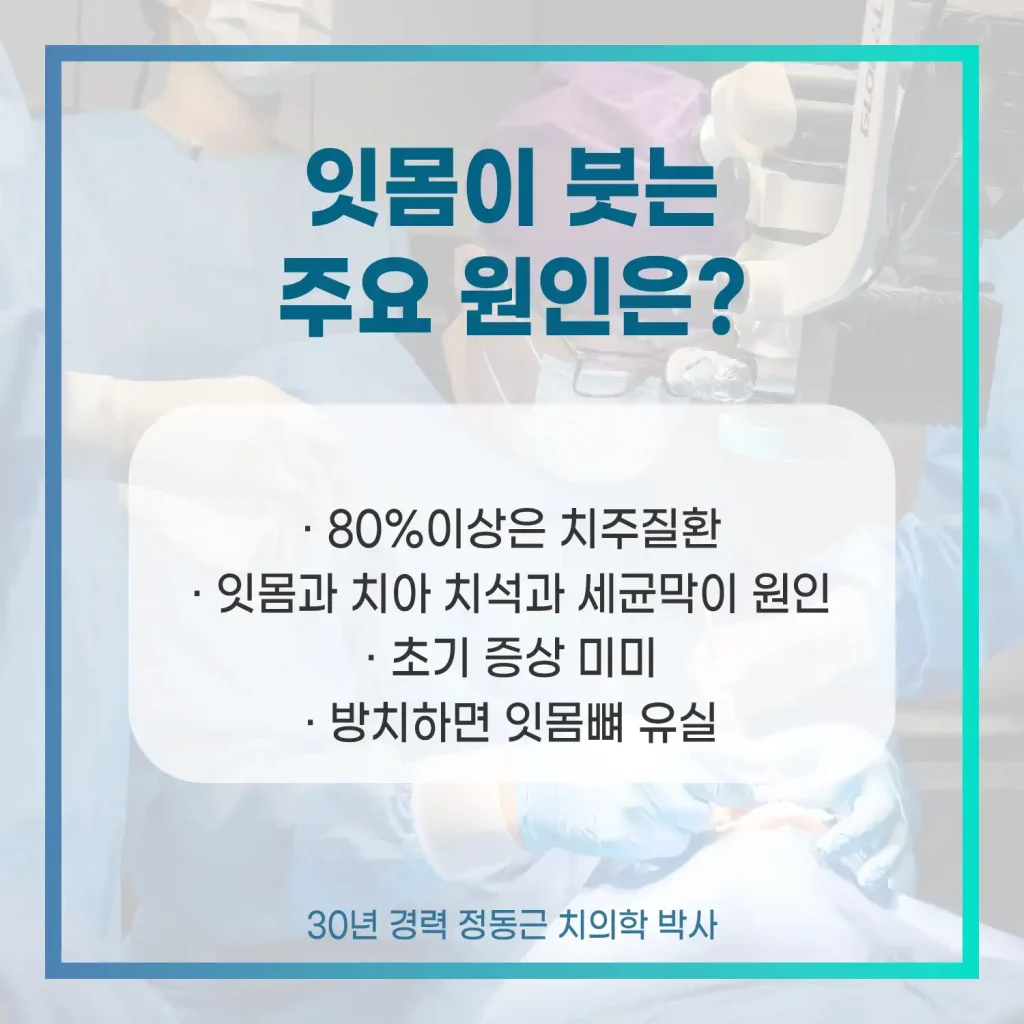 잇몸이붓는주요원인