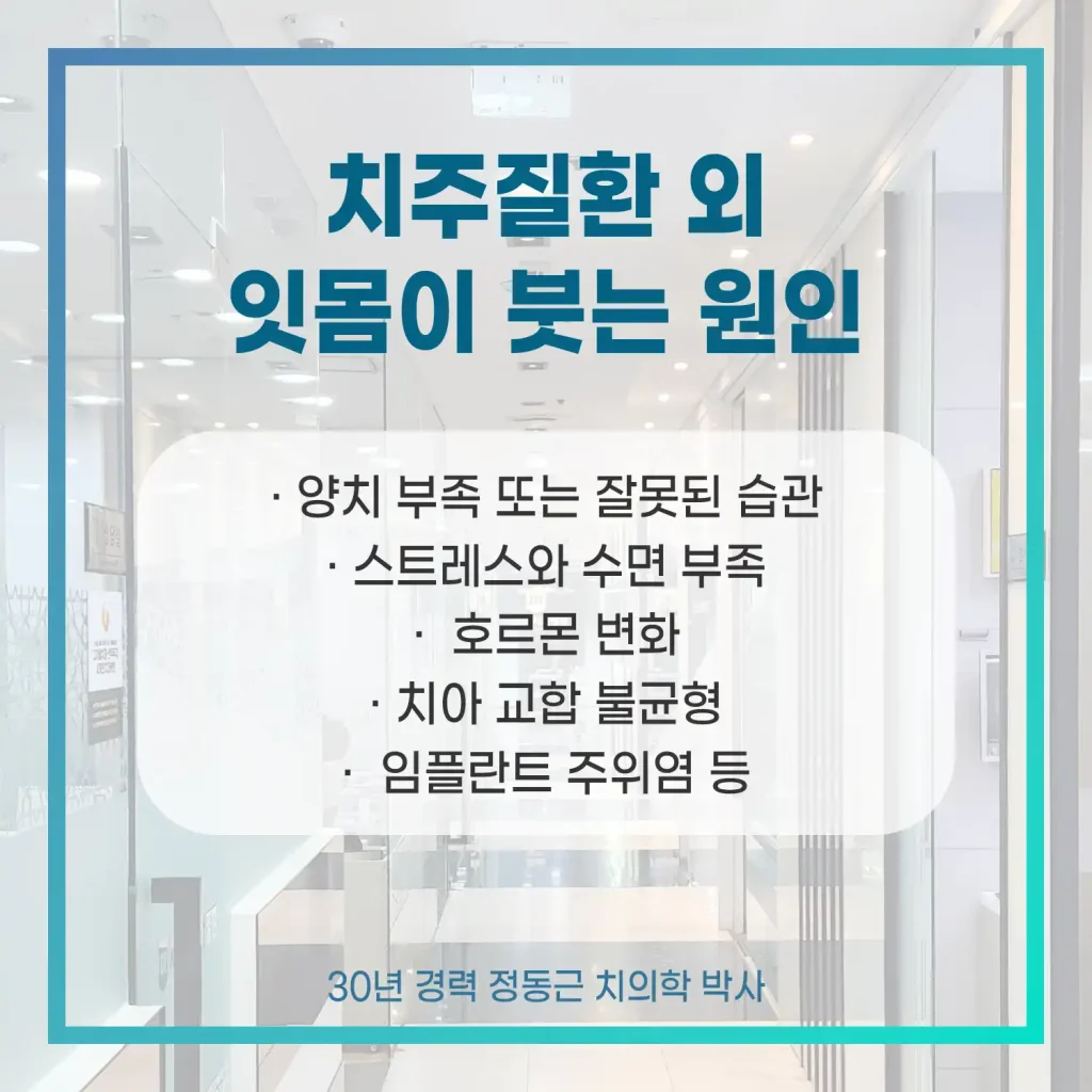 치주질환 외 잇몸이붓는이유