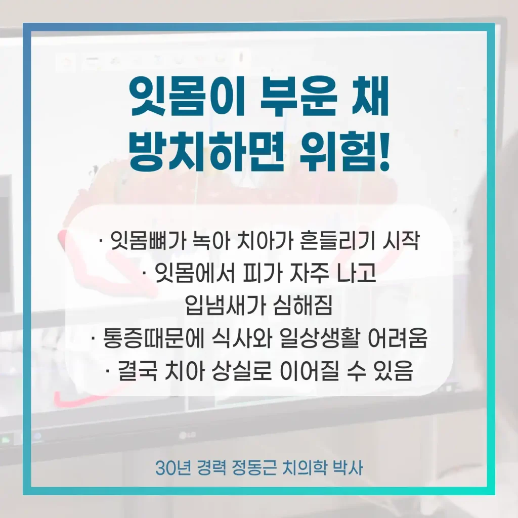 잇몸 붓기 방치하면 위험