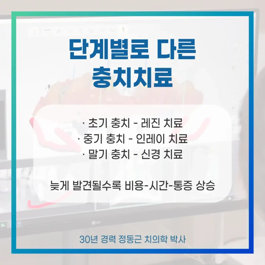 단볘별로 다른 충치치료