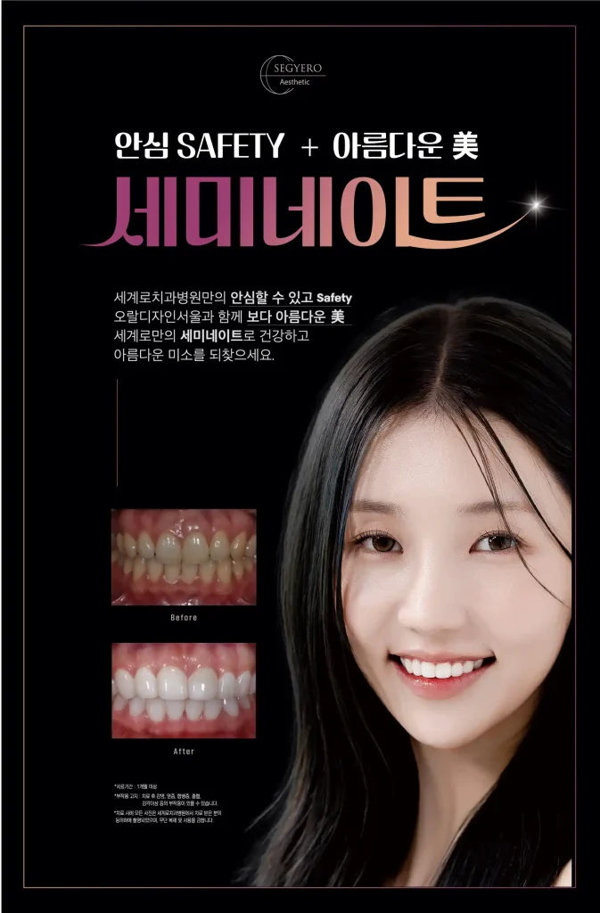 부산 앞니 부분 라미네이트