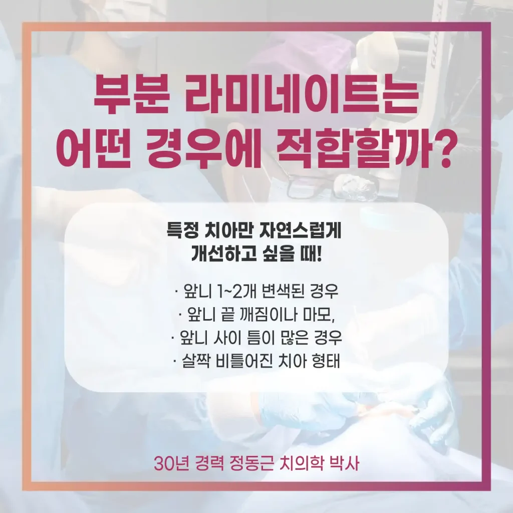 부산 앞니 부분 라미네이트 세계로치과병원