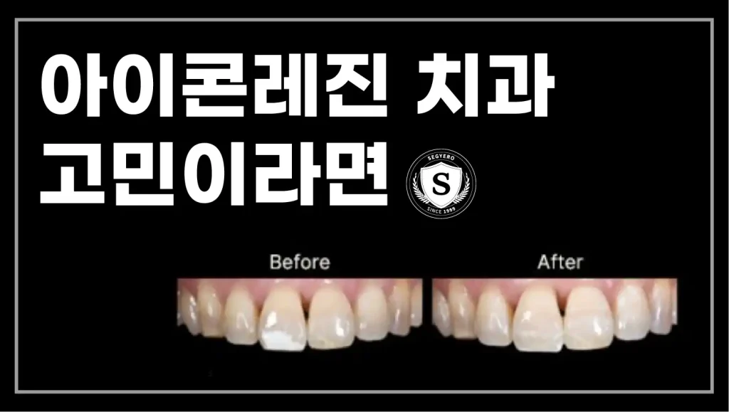 부산 아이콘 레진 치과