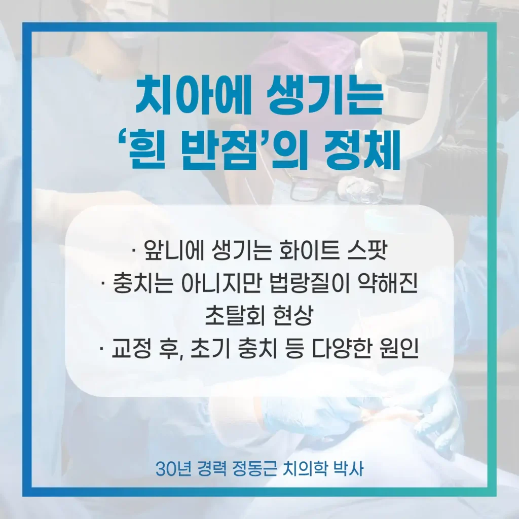 부산 아이콘 레진 치과 치아 흰 반점