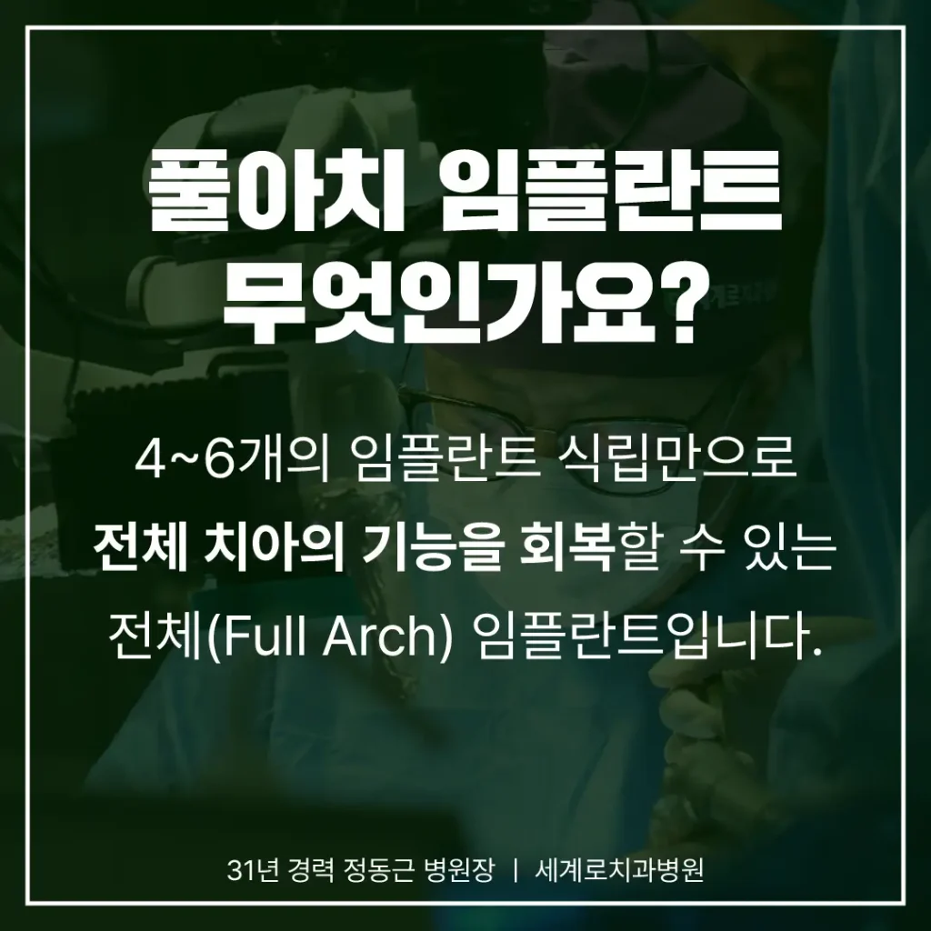 부산뼈이식임플란트가 필요한 경우