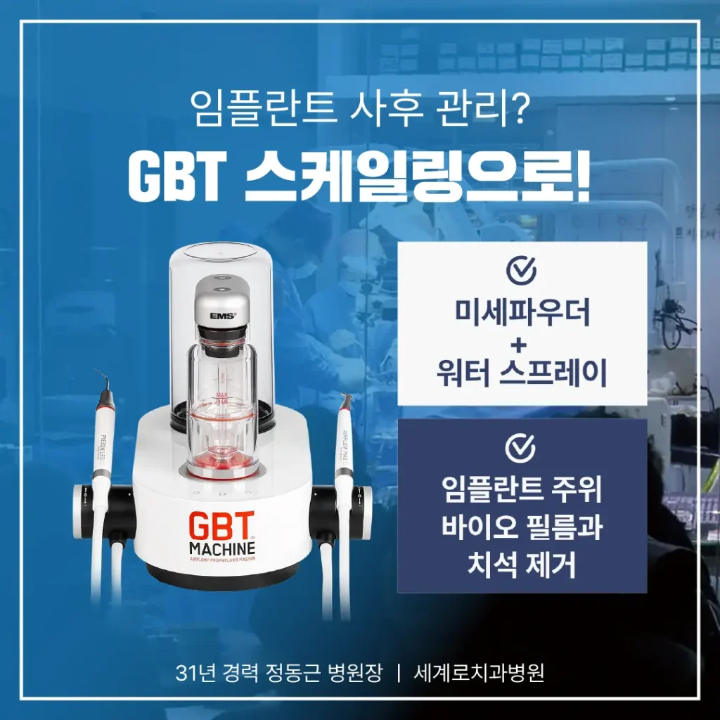 구강 건강을 지속적인 관리를 위해 GBT(Guided Biofilm Therapy)를 운영합니다.