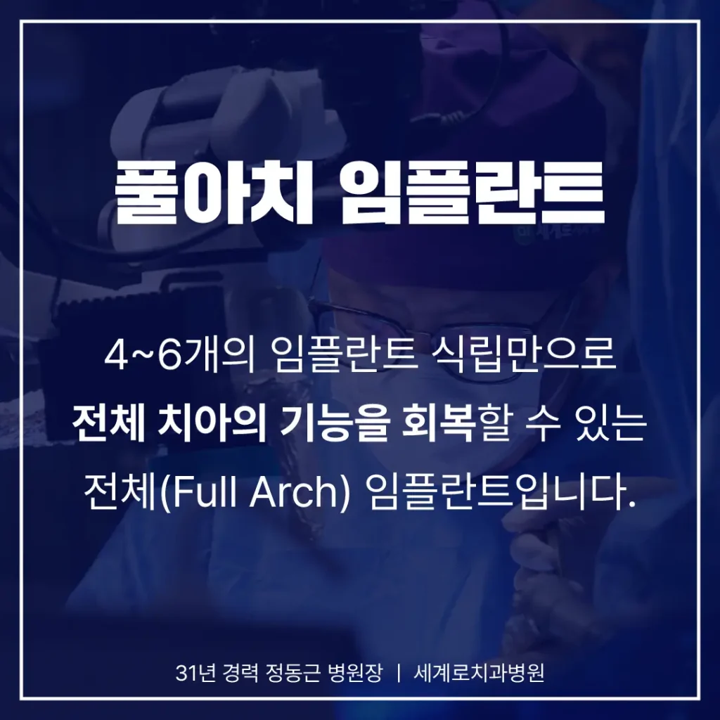 무치악 문제를 개선하기 위해 최근에는 풀아치임플란트가 주목