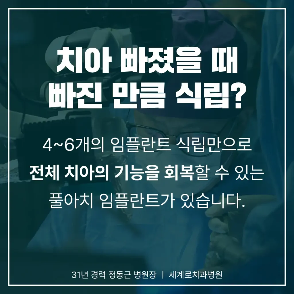 빠진 치아의 개수와 임플란트 개수가 달라지는 이유