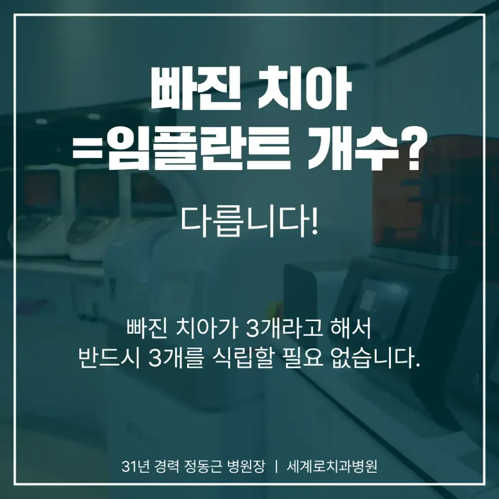 임플란트 개수는 환자마다 달라질 수 있습니다