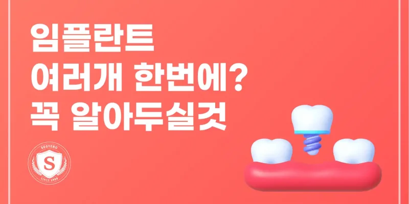 부산 임플란트 여러개 한번에 하는 곳 꼭 알아두실것
