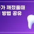 부산 임플란트 여러개 한번에 하는 곳 꼭 알아두실것