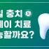 암환자 임플란트 가능할까?