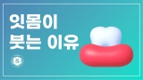 잇몸이붓는이유