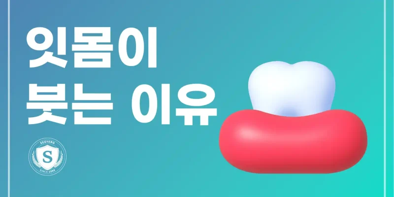 잇몸이붓는이유