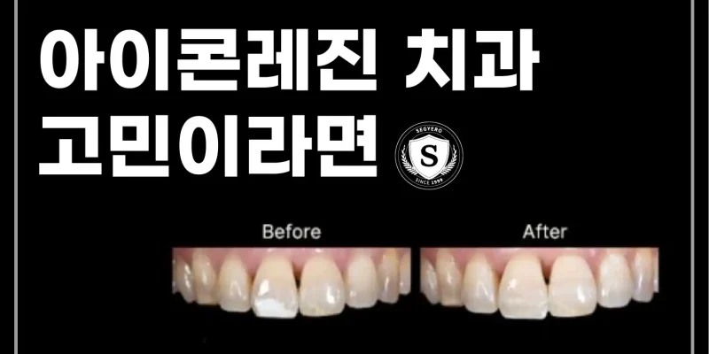 부산 아이콘 레진 치과 고민이라면