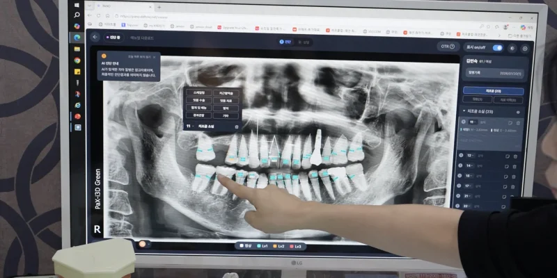 부산양심치과 말보다 AI로 객관적으로 증명